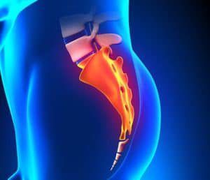 КТ крестцово-копчикового отдела позвоночника