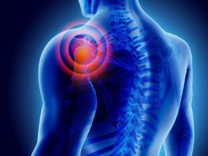 перелом ребер