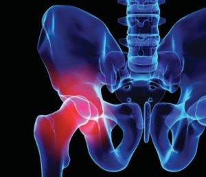 КТ костей таза