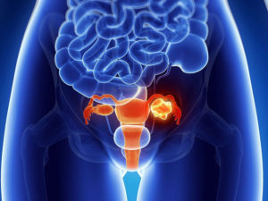 КТ органов малого таза в Запорожье