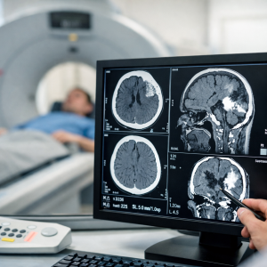 КТ после удара головой